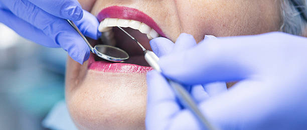 Best Emergency Tooth Extraction in Emerson, GA